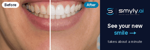 Before and after smile preview. See your new smile.