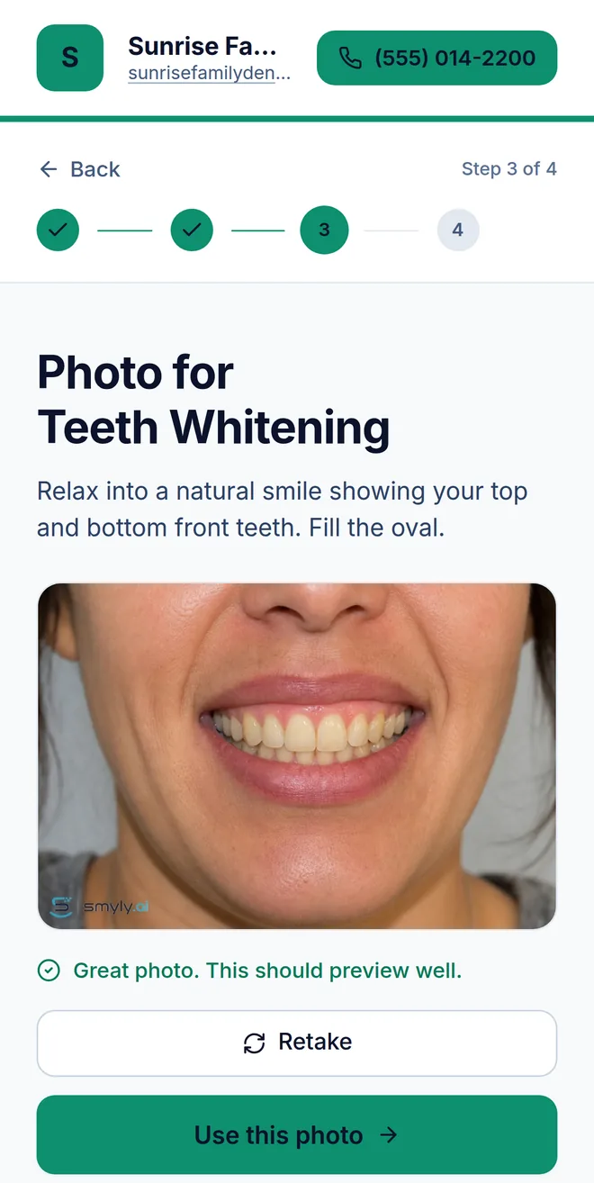 Step three on a phone: reviewing a smile photo before generating the preview