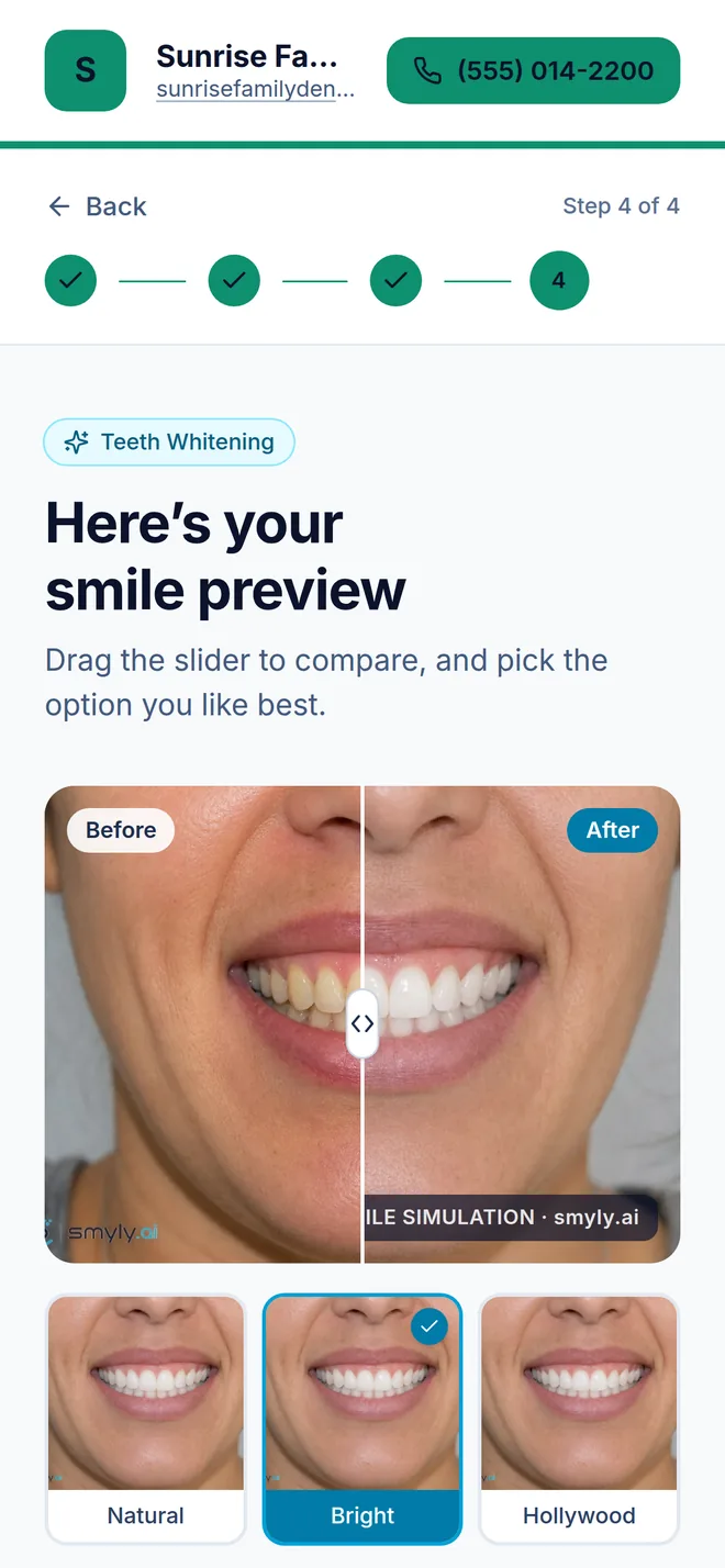 Step four on a phone: the before and after smile preview with three variant options